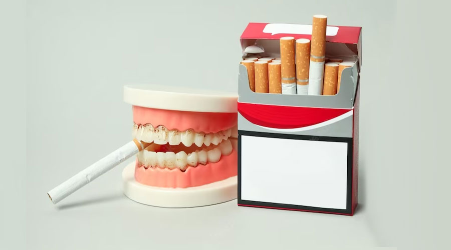 Smoking And Gum Disease