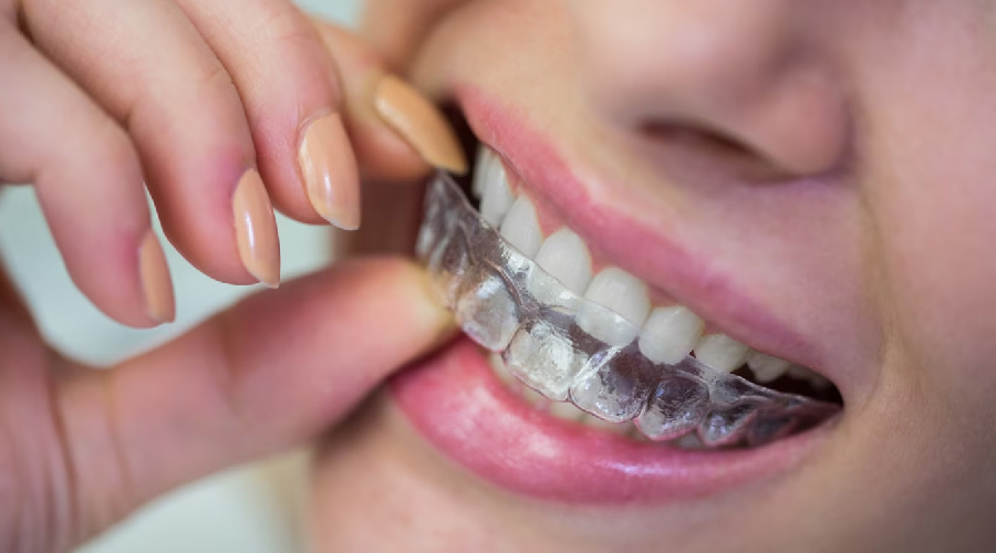 Invisalign Dentistry: A Guide to Finding the Best Orthodontic Care in Your Area